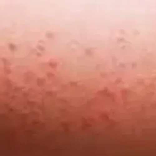 rs=w_600,h_300,cg_true (25)