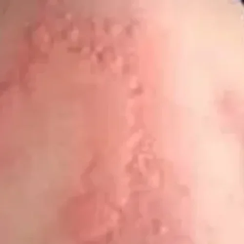 rs=w_600,h_300,cg_true (26)