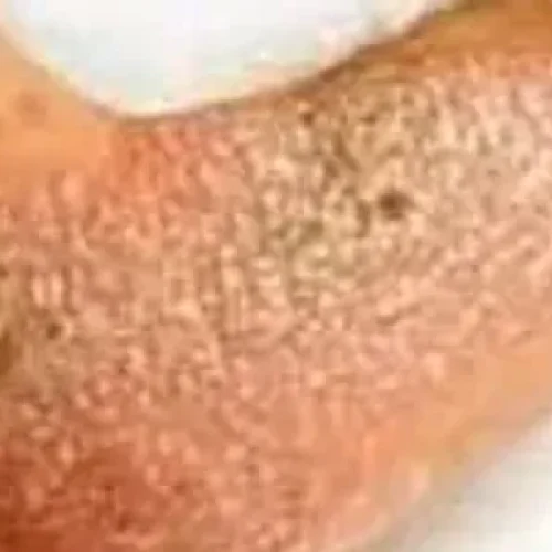 rs=w_600,h_300,cg_true (30)