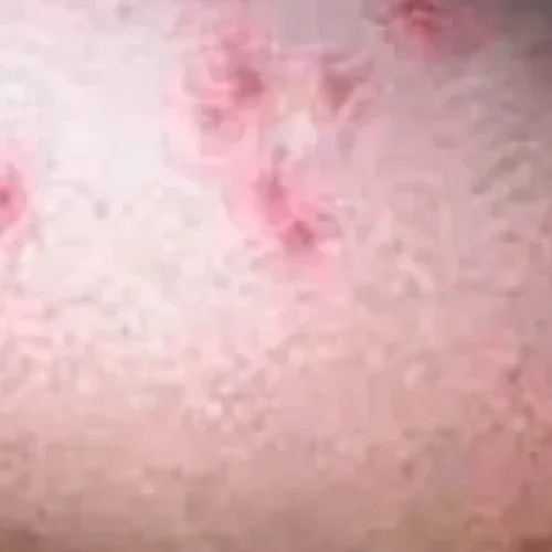 rs=w_600,h_300,cg_true (32)