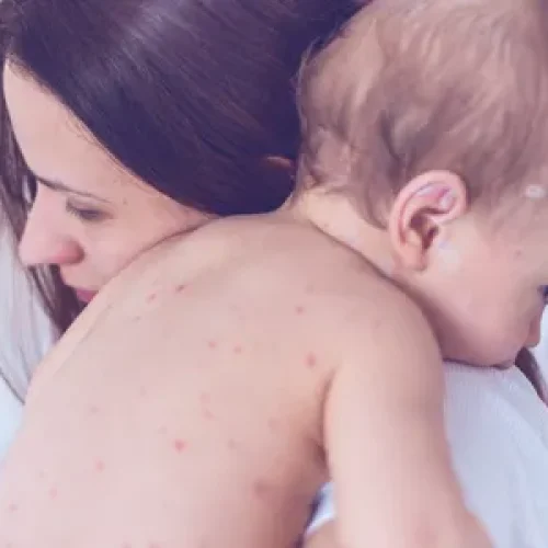 rs=w_600,h_300,cg_true (66)